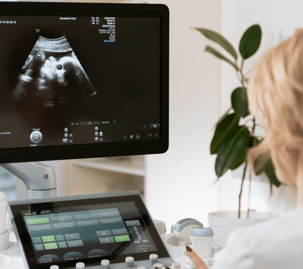 medical professional looking at ultrasound screen
